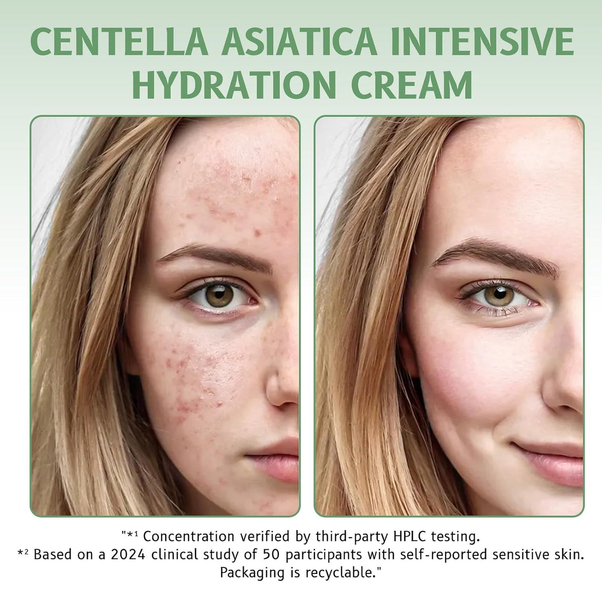 Centella Asiatica Cream for Sensitive Skin, 85% Natural Moisturizer, Intensive Hydration & Repair, 50g - ECOLOOM LLCCentella Asiatica Cream for Sensitive Skin, 85% Natural Moisturizer, Intensive Hydration & Repair, 50gECOLOOM LLCECOLOOM LLC