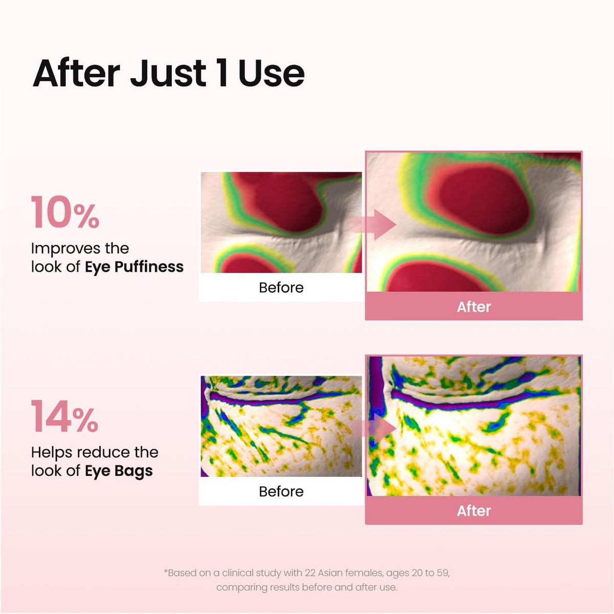 Hydrogel Eye Patches for Under Eye - Collagen Peptide, Anti Wrinkle & Fine Lines (60 Count) - ECOLOOM LLCHydrogel Eye Patches for Under Eye - Collagen Peptide, Anti Wrinkle & Fine Lines (60 Count)ECOLOOM LLCECOLOOM LLC